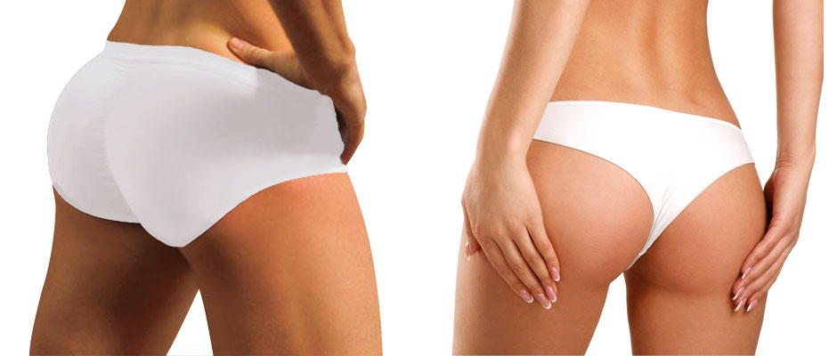 Bioplastía Glútea con PRP