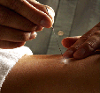 Acupuntura