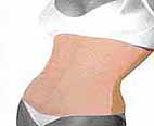 Elastoterapia